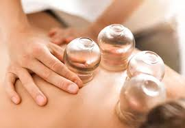 Chinese Medicine: cupping therapy on upper back